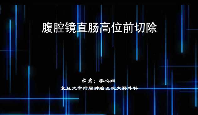 腹腔镜高位直肠前切除术